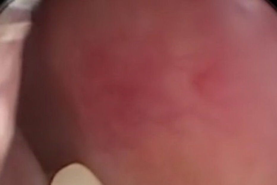 Mulher chinesa tinha dente no interior do nariz