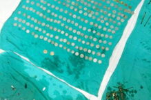 Médicos retiram centenas de agulhas e moedas de estômago de doente