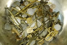 Médicos encontram 263 moedas e 100 pregos em estômago de paciente