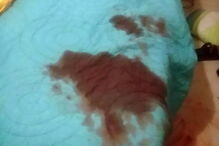 Brenda cortou o pénis e testículos ao namorado