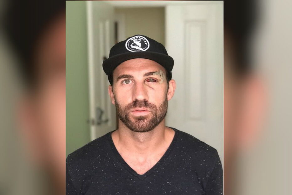 turista agredido lisboa