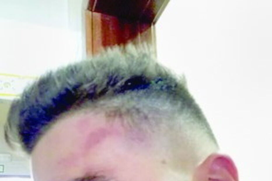 PSP, agressão, agredido, esquadra, espancado, Escola Secundária Sebastião da Gama, Setúbal