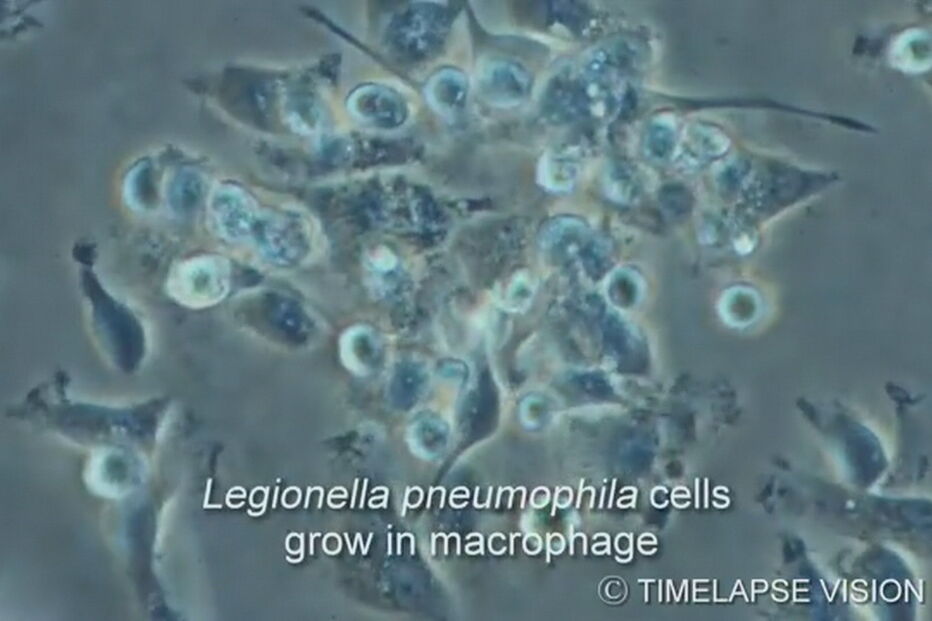 Bactéria da legionella detetada no sistema de água do Hospital Francisco Xavier 