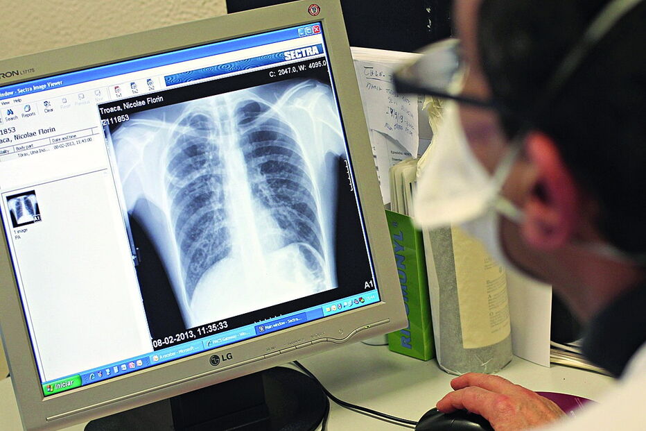 Diagnóstico é realizado através de uma radiografia ao tórax