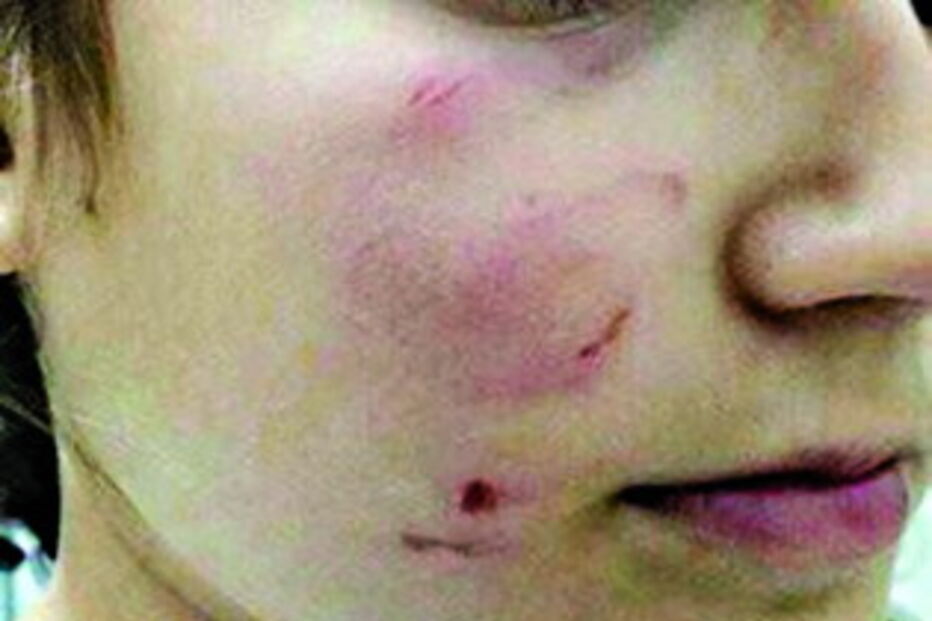 Jovem sofreu ferimentos