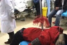 lança, homem, perfurado, China