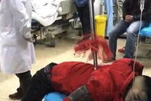 lança, homem, perfurado, China