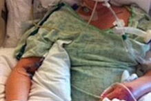 Infeção causada por tampão leva jovem a amputar pernas