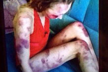 Anastasia foi morta à pancada pelo marido