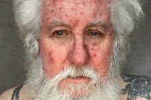 O Pai Natal Dave Upson está com varicela e foi obrigado a 'cancelar' o Natal