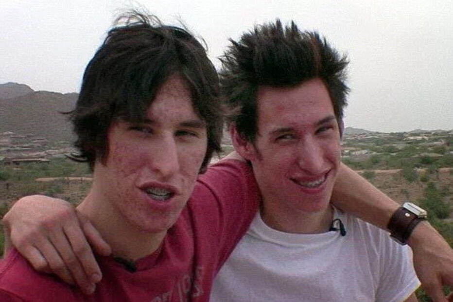 gémeos, Brad Pitt, cirurgias, operações, Matt Schlepp, Mike Schlepp