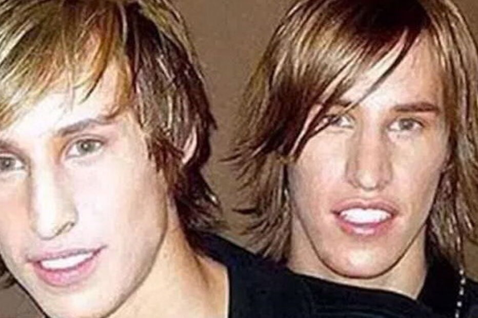 gémeos, Brad Pitt, cirurgias, operações, Matt Schlepp, Mike Schlepp