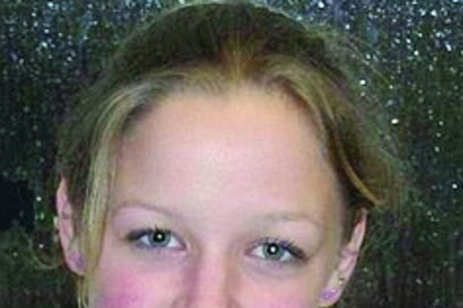 Eleanor Chessell sofreu queimaduras graves na cara e no corpo