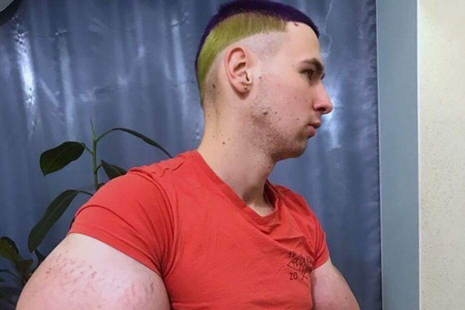 Popeye, músculos, corpo, óleo, braços, amputação, Rússia, Instagram, Kirill Tereshin