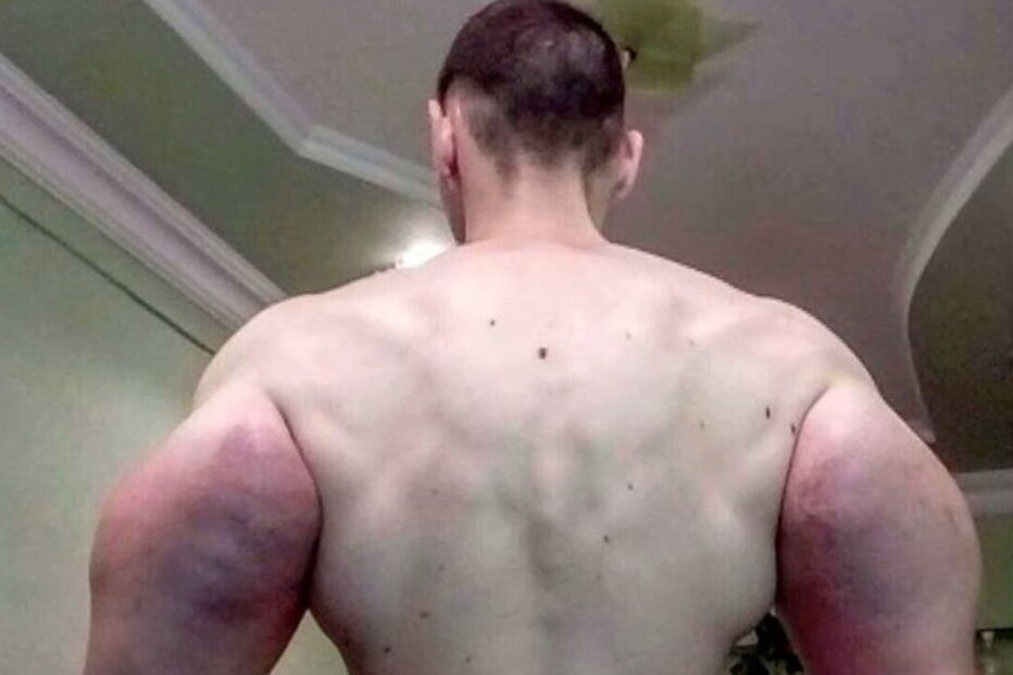 Popeye, músculos, corpo, óleo, braços, amputação, Rússia, Instagram, Kirill Tereshin