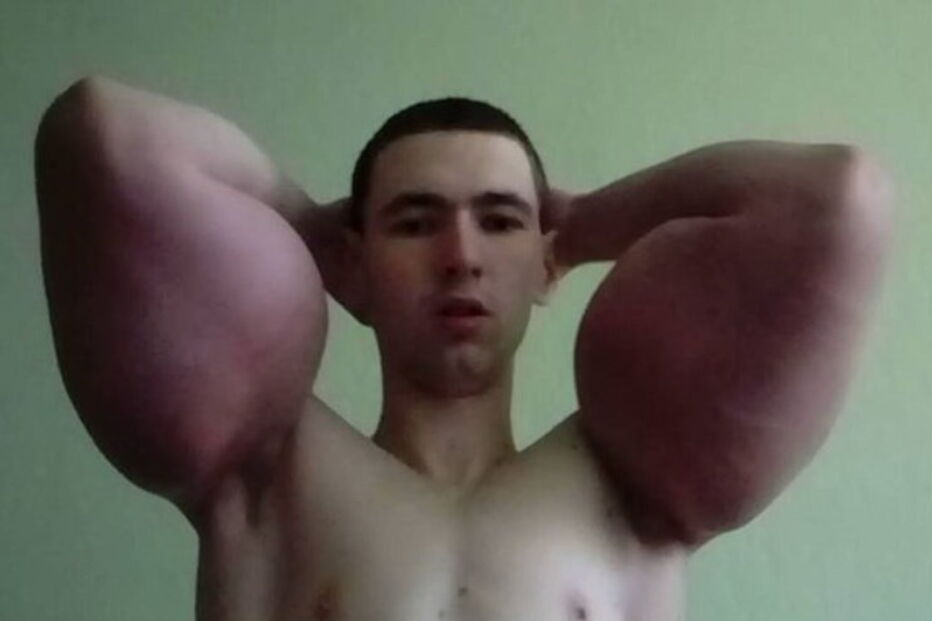 Popeye, músculos, corpo, óleo, braços, amputação, Rússia, Instagram, Kirill Tereshin