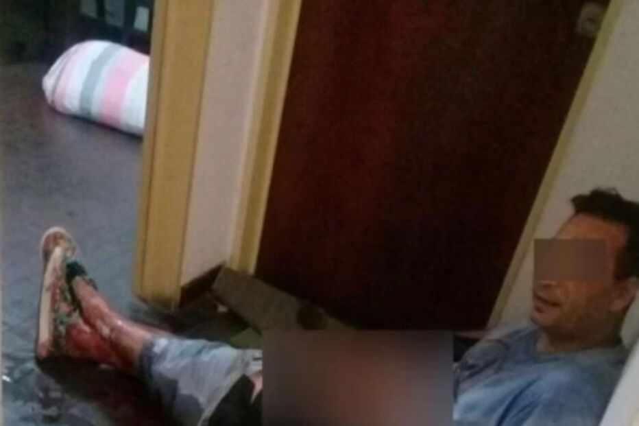 Arranca testículo do 'ex' com os dentes por ter negado sexo a três