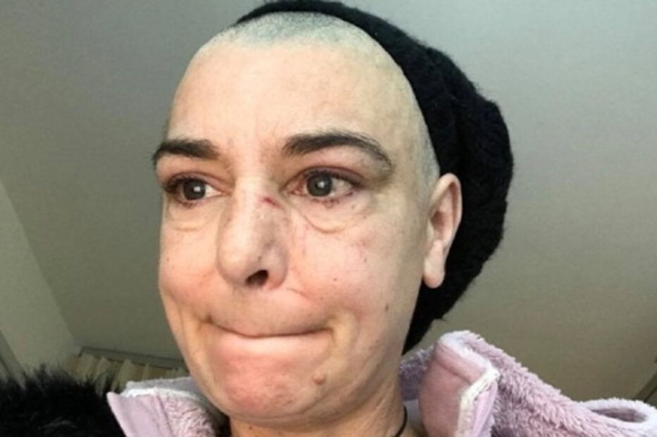 Filho bate em Sinéad O'Connor após discussão e parte-lhe um tornozelo