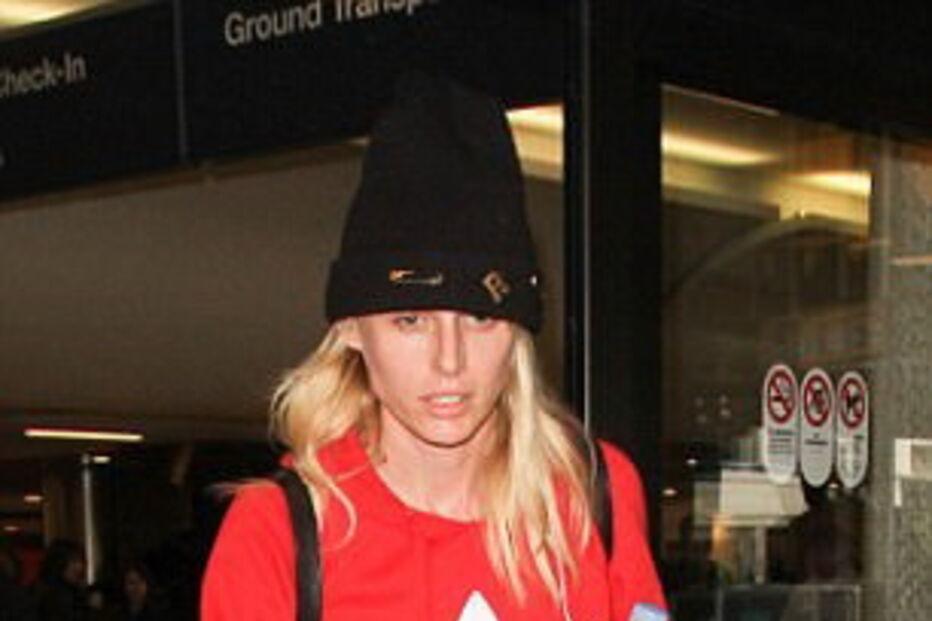 Infeção causada por tampão leva jovem a amputar pernas