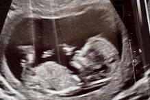 Reanna Stephens tem 18 anos e está grávida de seis meses