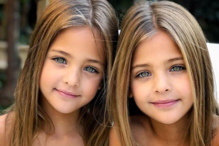 Gémeas fazem sucesso nas redes sociais