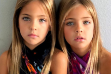 Gémeas fazem sucesso nas redes sociais