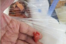 Manushi nasceu com 400 gramas. Saiu agora do hospital, com seis meses