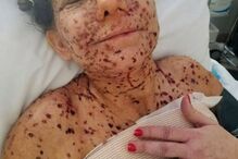 Libby Huffer, doença, tumor, EUA