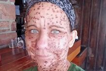 Libby Huffer, doença, tumor, EUA