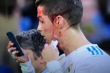 Ronaldo lesiona-se durante jogo