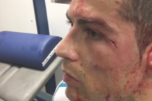 Cristiano Ronaldo lesionado