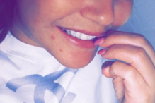 Katia Aveiro publica foto sem maquilhagem e com borbulhas