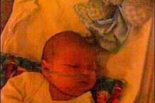 Menino sofre de síndrome que só lhe permite ter uma expressão facial