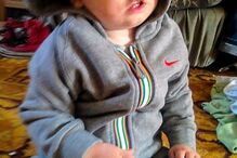 Menino sofre de síndrome que só lhe permite ter uma expressão facial