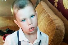 Menino sofre de síndrome que só lhe permite ter uma expressão facial