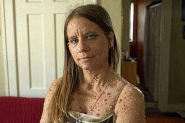 Libby Huffer, doença, tumor, EUA