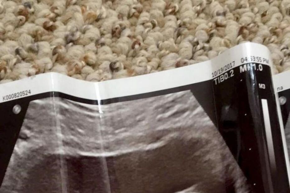 Reanna Stephens tem 18 anos e está grávida de seis meses