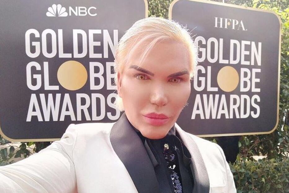 Rodrigo Alves, o 'Ken Humano', foi de branco aos Globos de Ouro