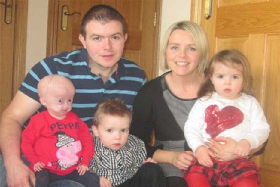 Morreu Lucy, a menina com doença rara que a fazia envelhecer oito vezes mais rápido