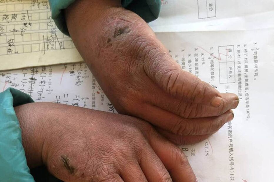 Menino chega à escola com cabelo congelado após caminhar um quilómetro