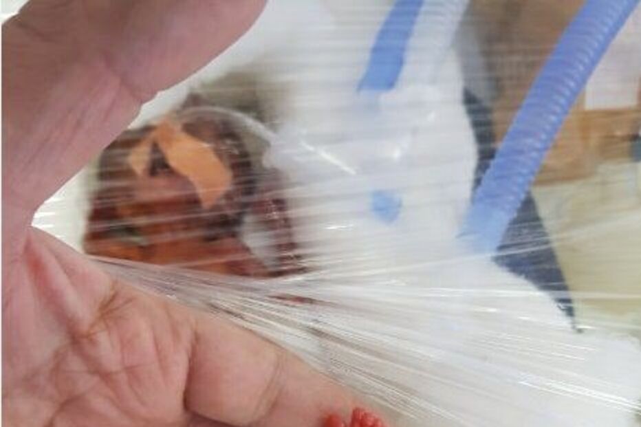 Manushi nasceu com 400 gramas. Saiu agora do hospital, com seis meses