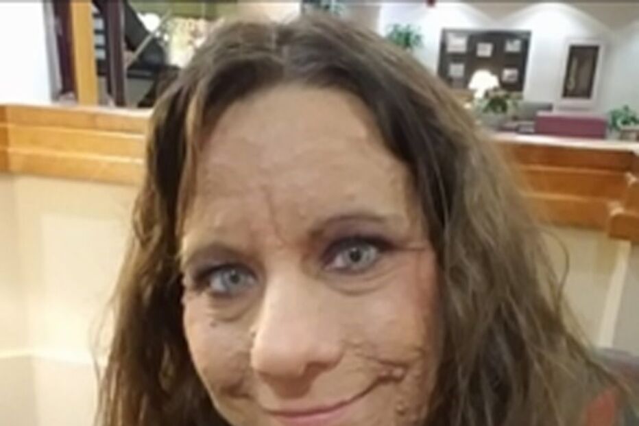 Libby Huffer, doença, tumor, EUA