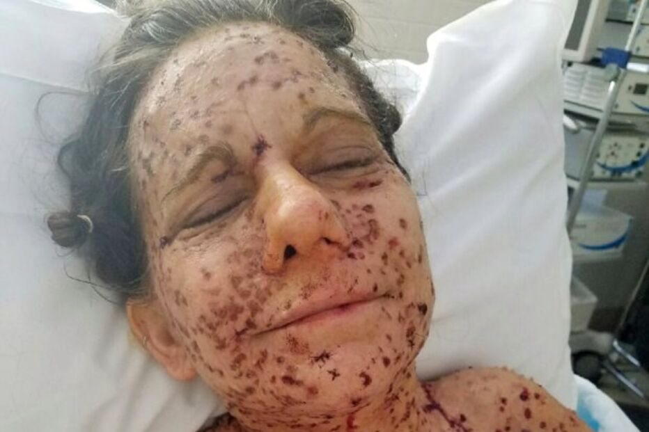 Libby Huffer, doença, tumor, EUA