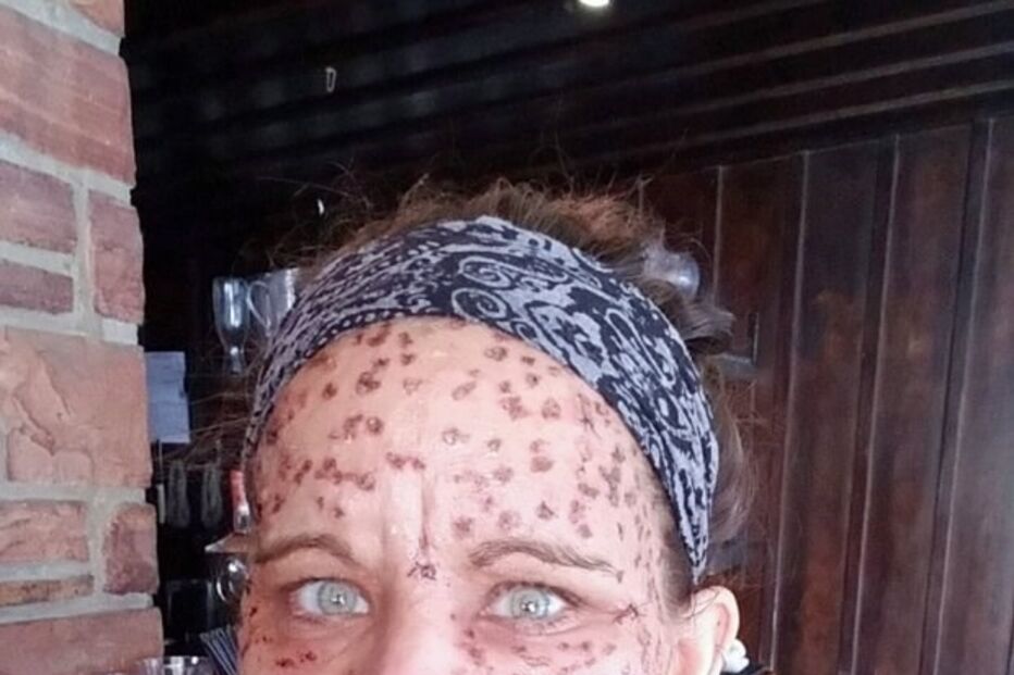 Libby Huffer, doença, tumor, EUA