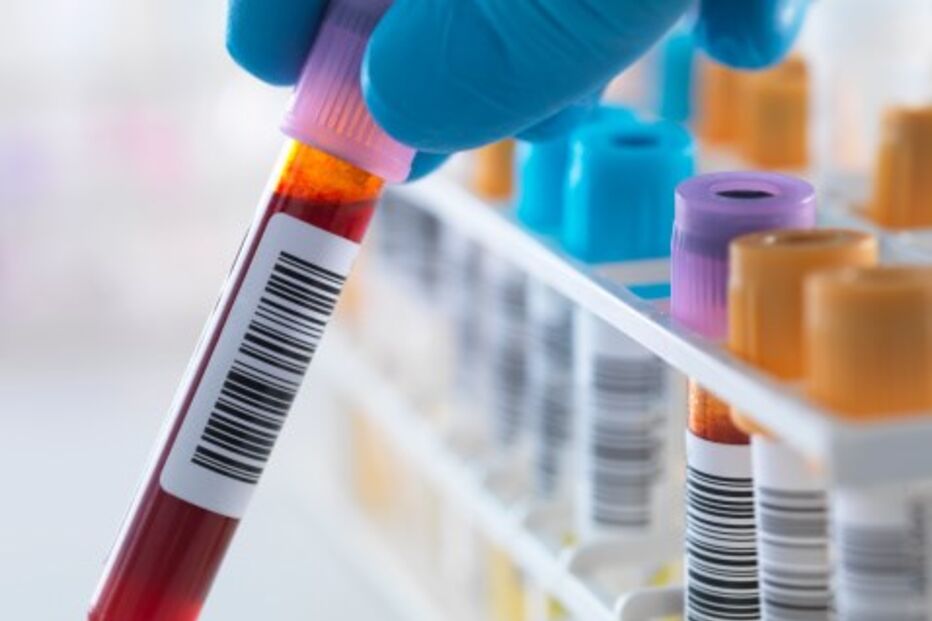 Teste sanguíneo