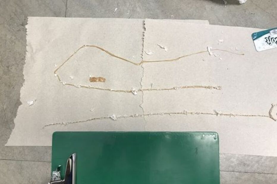 ténia, eua, doença