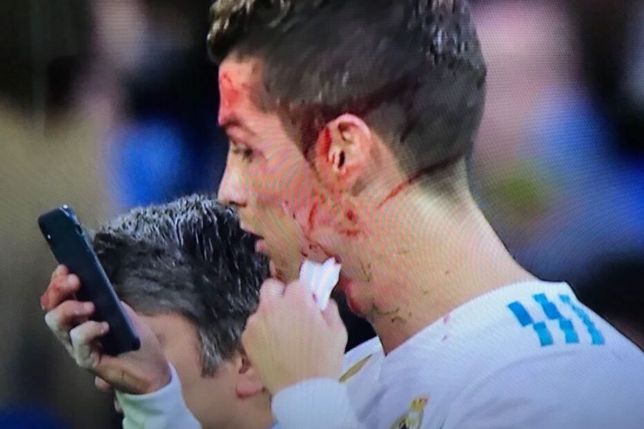 Ronaldo lesiona-se durante jogo
