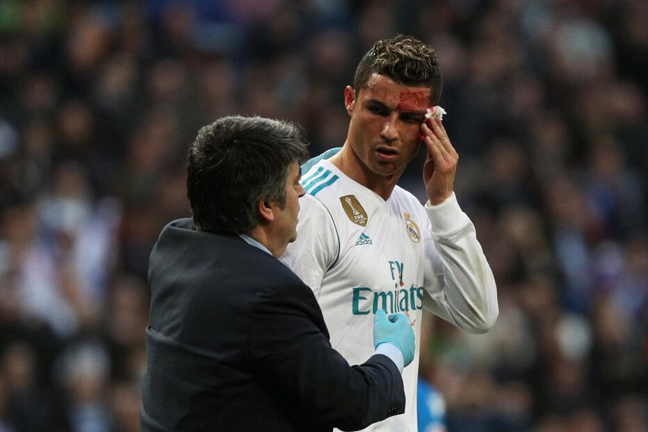 Ronaldo lesiona-se durante jogo