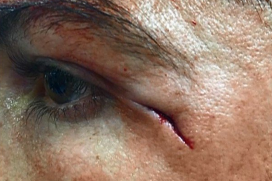 Cristiano Ronaldo lesionado