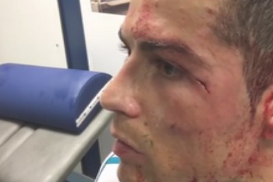 Cristiano Ronaldo lesionado